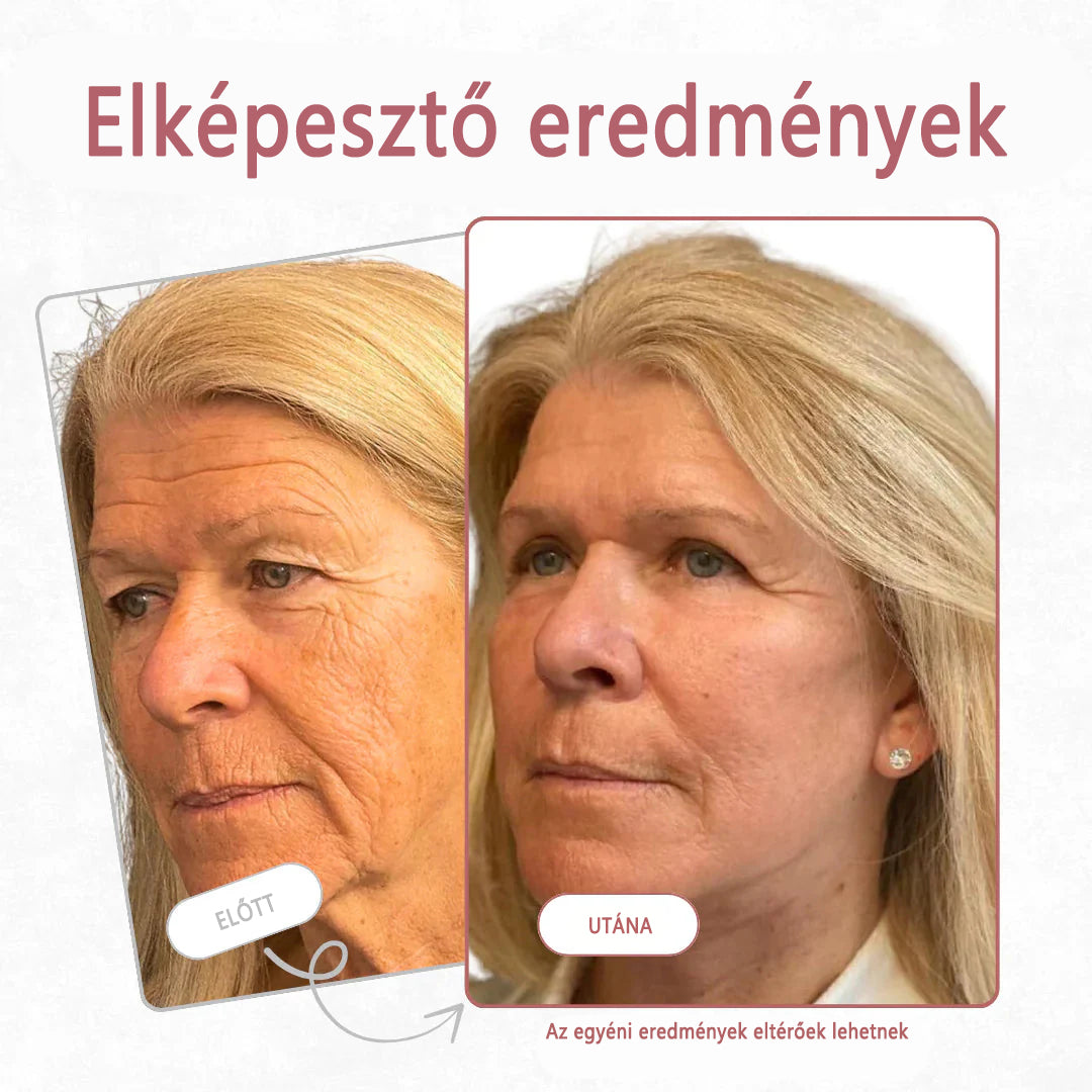 Bestsellerowy krem Solaroza @ Calcium Polycollagen Improvement Cream – zawiera jony wapnia, heksapeptyd-8 oraz ekstrakty z kolagenu roślinnego, które działają na zmarszczki, zapewniając szybką poprawę i 100% efekt przeciwstarzeniowy.