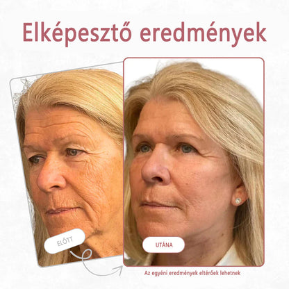 Bestsellerowy krem Solaroza @ Calcium Polycollagen Improvement Cream – zawiera jony wapnia, heksapeptyd-8 oraz ekstrakty z kolagenu roślinnego, które działają na zmarszczki, zapewniając szybką poprawę i 100% efekt przeciwstarzeniowy.