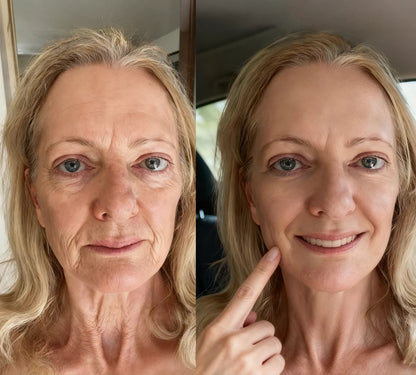 Bestsellerowy krem Solaroza @ Calcium Polycollagen Improvement Cream – zawiera jony wapnia, heksapeptyd-8 oraz ekstrakty z kolagenu roślinnego, które działają na zmarszczki, zapewniając szybką poprawę i 100% efekt przeciwstarzeniowy.